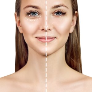 before and after face showing the effects of collagen in the process of aging