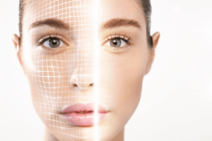 Radiofrequency Skin Rejuvenation