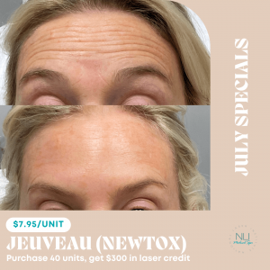 woman before and after jeuveau injections