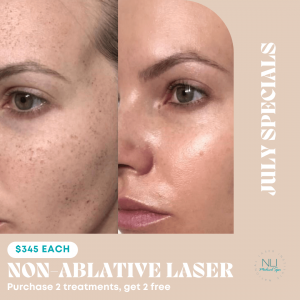 woman non-ablative laser before and after results