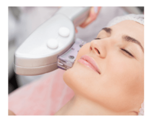 ematrix photofacial treatments