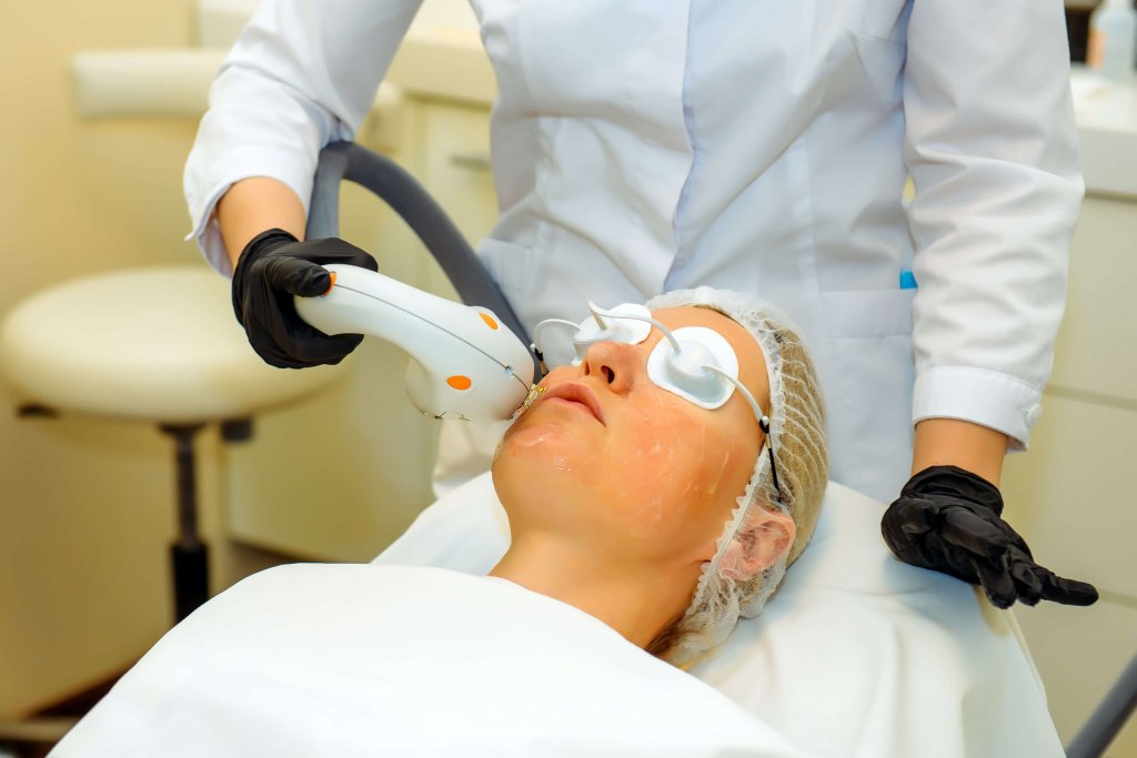 Photofacial Around Phoenix - National Laser Institute Medical Spa