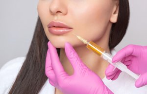 lip injections dermal filler