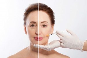 Phoenix dermal fillers treatments 