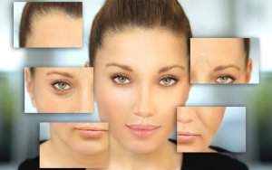 Phoenix injectable Botox 