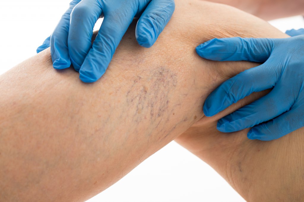 Southwest Vein Laser Institute Home Facebook