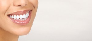 Confident Smile Teeth Whitening Treatment