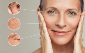 Scottsdale wrinkle treatments